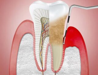 https://studiokalaj.it/wp-content/uploads/2022/09/periodontologia1-320x245.jpg